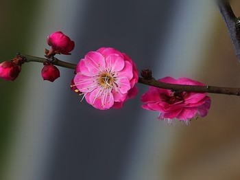 男生的膀胱和女生的膀胱容量